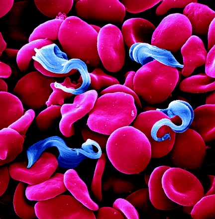 Trypanosoma 1.jpg